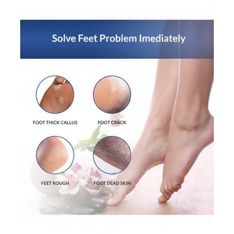 Pro-Grade Laser Foot Scraper & Dual-Sided Filer