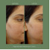 Kamill Sunder Kaya Fairness Cream For Pimples, Blemishes And Acne (12 gms)