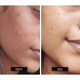 Kamill Sunder Kaya Fairness Cream For Pimples, Blemishes And Acne (12 gms)